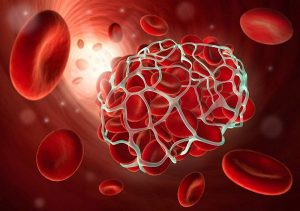 جلوگیری از خون‌ریزی در کمتر از ۱۰ ثانیه با بندآورنده‌های نانو الیاف پپتیدی