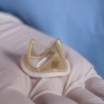 استفاده از یک بیوپلیمر برای تولید دریچه آئورت مصنوعی