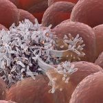 استفاده از ماتریس پلیمری در نانوذره مهندسی جهت درمان سرطان